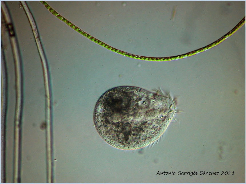 Ciliato da determinare